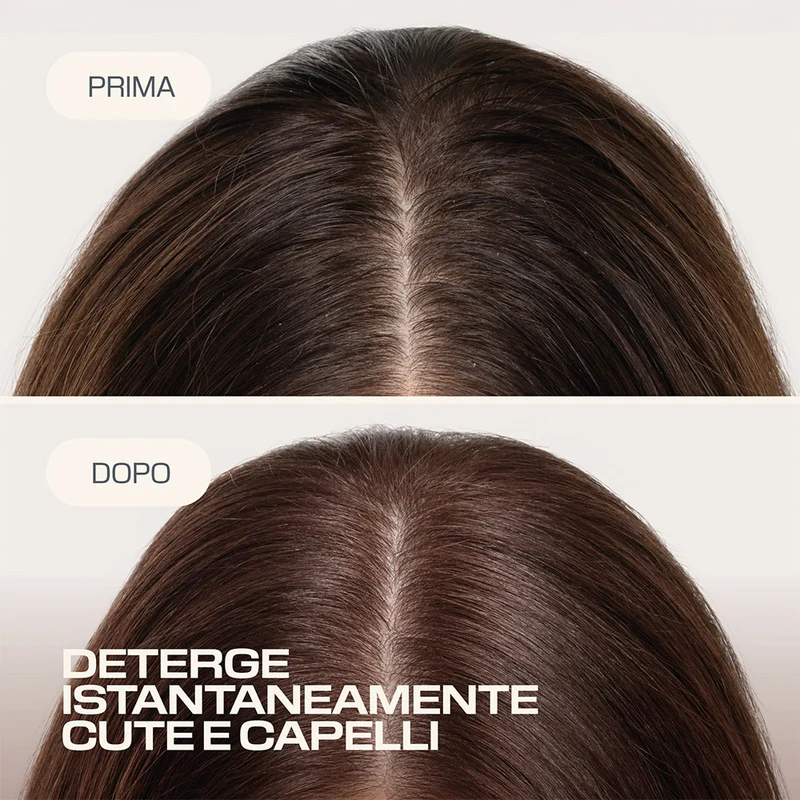 Goldwell Dualsenses Scalp Specialist Rebalance & Hydrate Fluid 150ml - trattamento cuoio capelluto secco