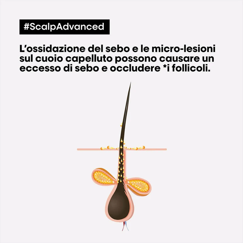 L'Oreal Professionnel Paris Scalp Advanced Anti-Oiliness Shampoo 500ml - shampoo sebo regolarizzatore