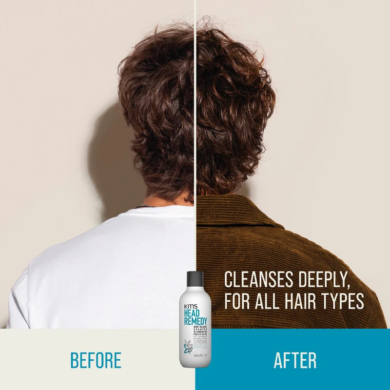 KMS Head Remedy Deep Cleanse Shampoo 300ml - shampoo pulizia profonda
