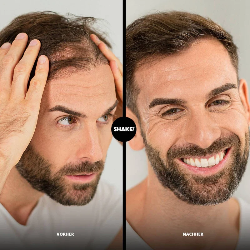SHAKE OVER Fibre per Capelli con Zinco