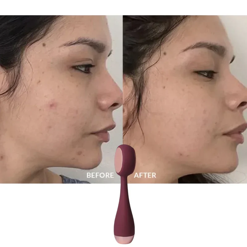 PMD Beauty Clean Pro Spazzola Viso Sonica SonicGlow™