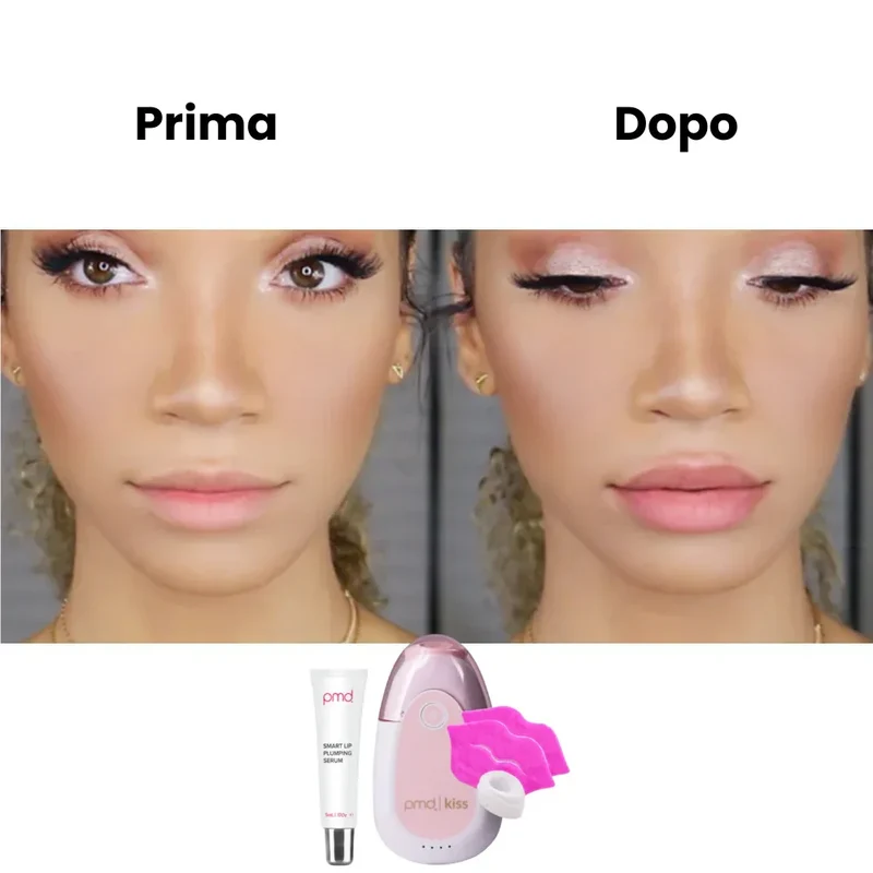 PMD Beauty Kiss Sistema Volume Labbra Anti-Age con Vacuum