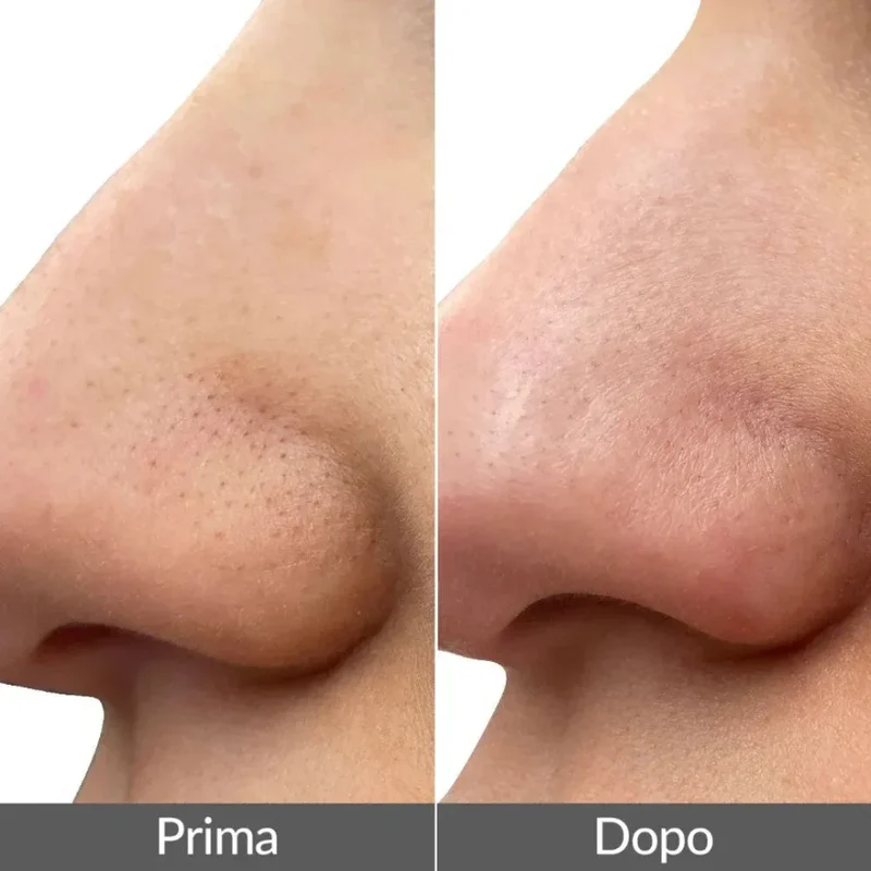 PMD Beauty Wave Pro Spatola Ultrasuoni EMS Viso
