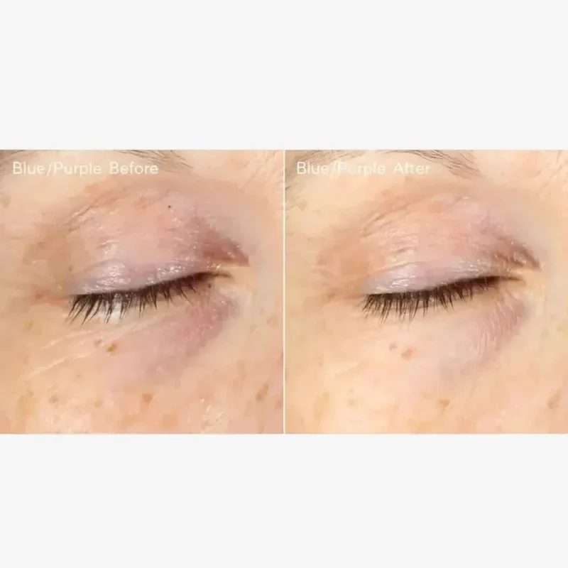 Murad Vita-C Eyes Dark Circle Corrector 15ml