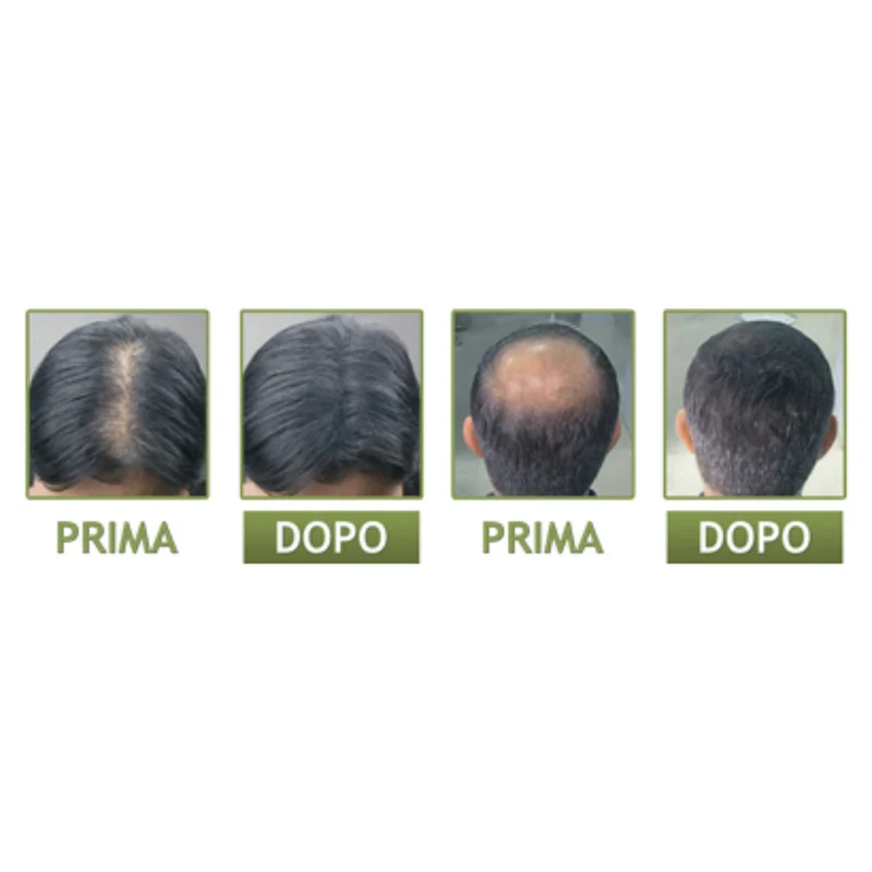 Hairganic+ Hair Max Pro Infoltimento e Volume ai Capelli