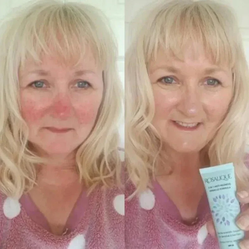 Rosalique 3 in 1 Anti Redness Miracle Formula SPF50 crema anti-rossore 30ml
