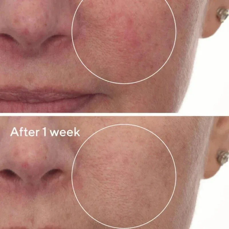 Murad Cellular Hydration Repair Serum viso 30ml