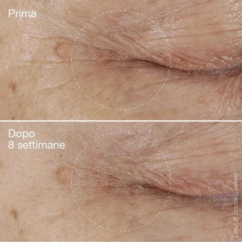 Dermalogica BioLumin-C Eye Serum Trattamento Contorno Occhi 15ml