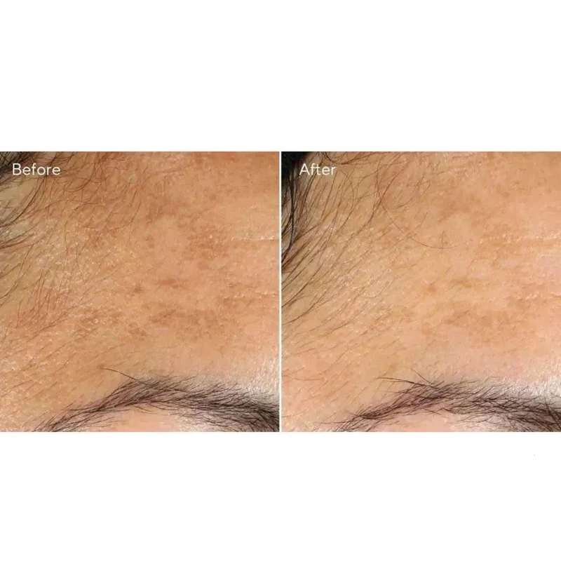 Murad Vita-C Glicolic Brightening Siero vitamina C illuminante 30ml
