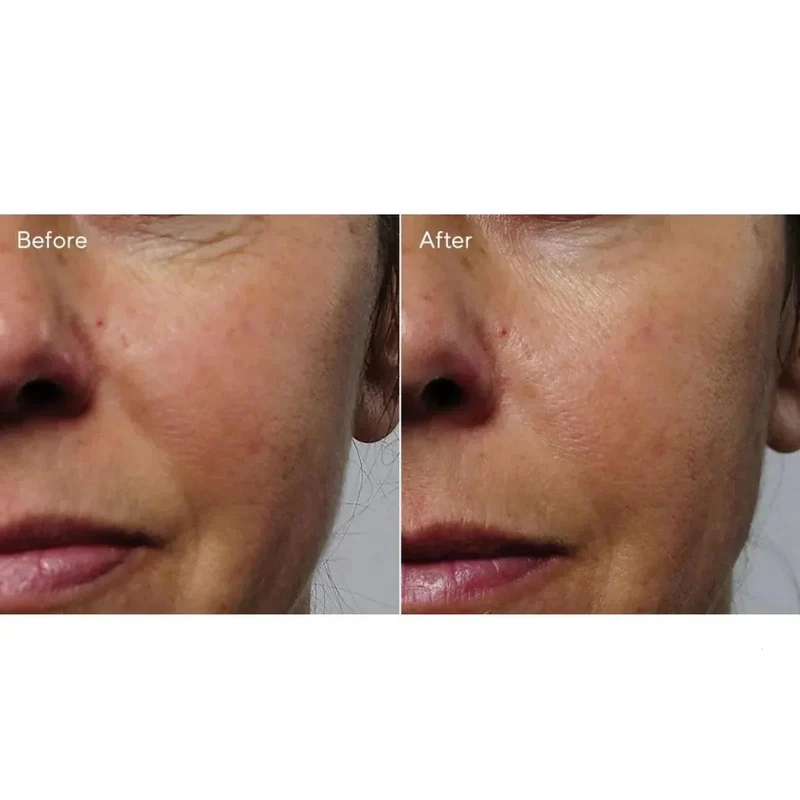 Murad Rapid Collagen Infusion siero collagene 30ml