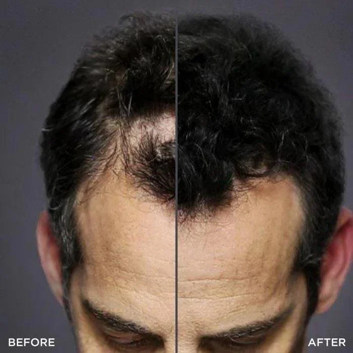 Toppik Kit Hair Duo (erogatore + pettinino)