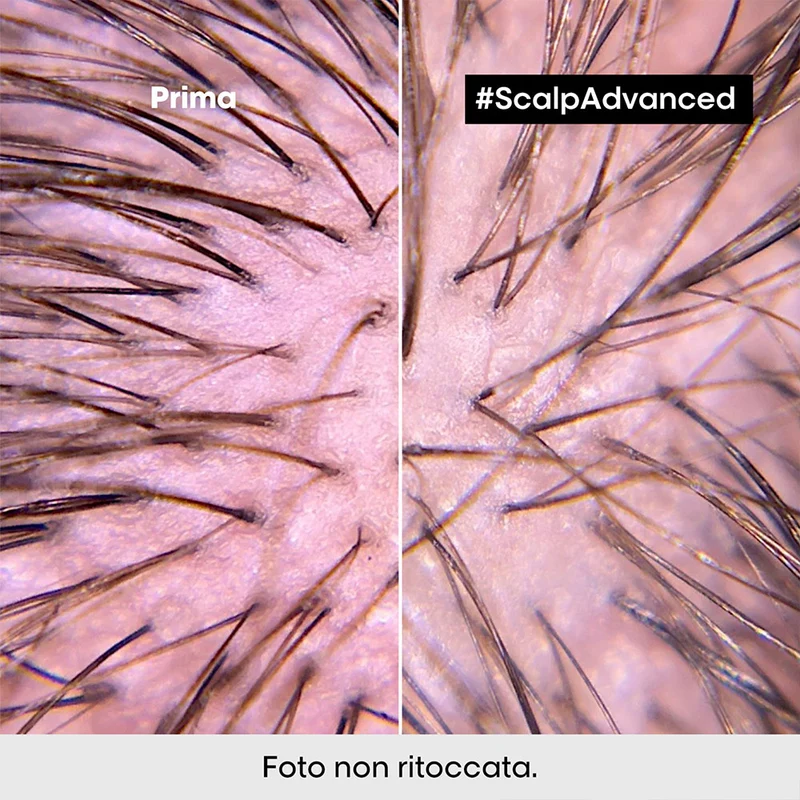 L'Oreal Professionel Scalp Advanced Anti-Discomfort Intense Soother 200ml - trattamento lenitivo