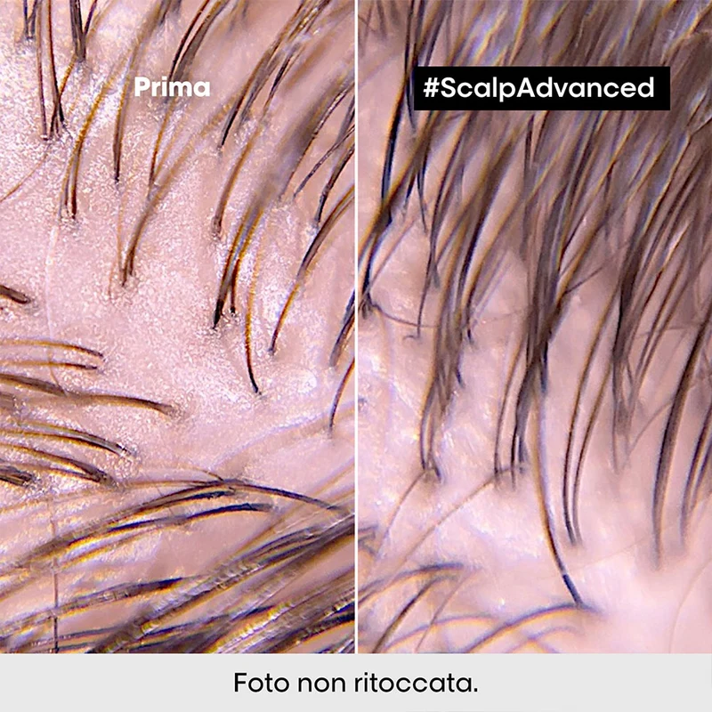 L'Oreal Professionnel Paris Scalp Advanced Anti-Oiliness 2in1 Deep Purifier Clay 250ml - shampoo & maschera purificante
