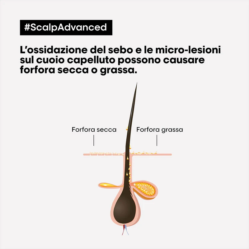 L'Oreal Professionnel Paris Scalp Advanced Anti-Dandruff Shampoo 300ml - shampoo anti forfora
