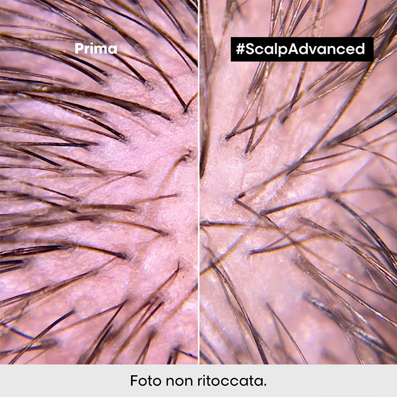 L'Oreal Professionnel Paris Scalp Advanced Anti-Discomfort Shampoo 300ml - shampoo lenitivo