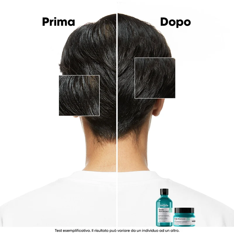 L'Oreal Professionnel Paris Scalp Advanced Anti-Oiliness Shampoo 300ml - shampoo sebo regolarizzatore