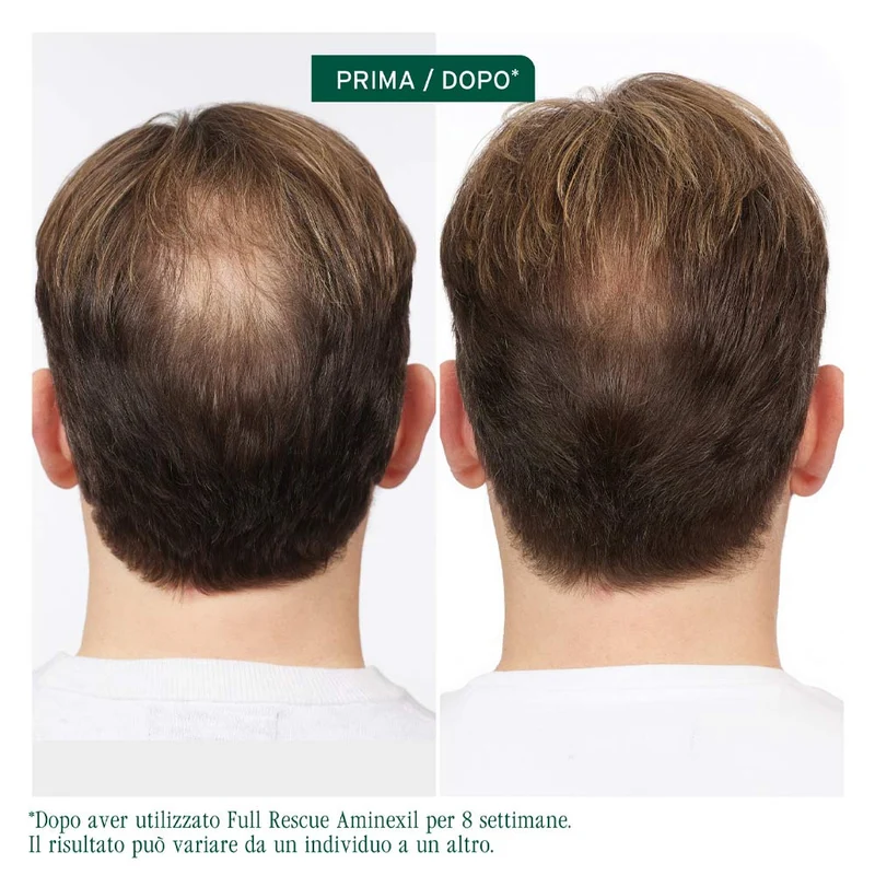 Biolage Professional Hair Spa Full Rescue Aminexil 6x10ml - fiale anti caduta
