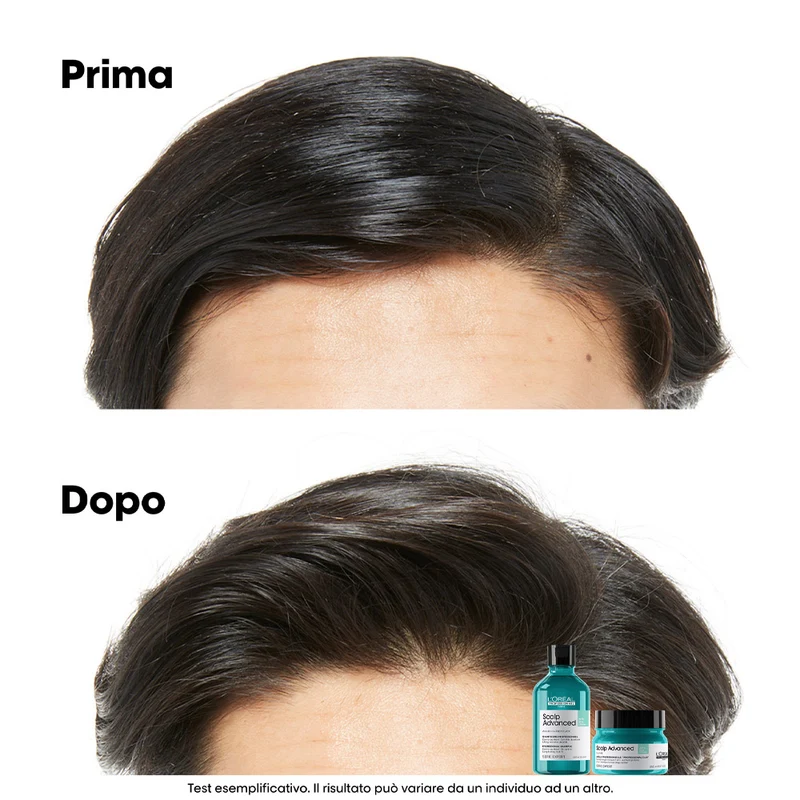 L'Oreal Professionnel Paris Scalp Advanced Anti-Oiliness Shampoo 500ml - shampoo sebo regolarizzatore