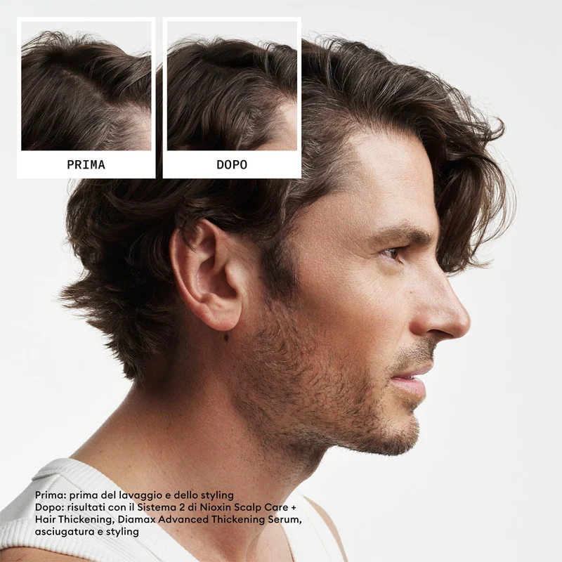 Nioxin Sistema 2 Kit Trifasico 150ml - kit anti assottigliamento avanzato