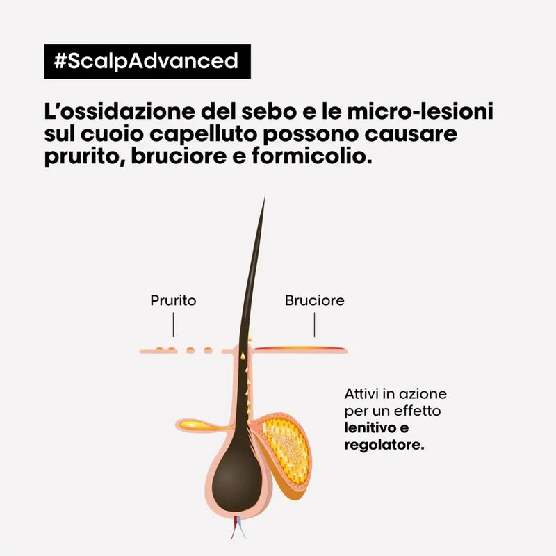 L'Oreal Trattamento Lenitivo Intense Soother – Scalp Advanced 200 ml
