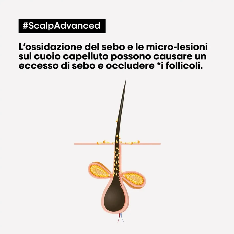 L'Oreal Scalp Advanced Shampoo Anti-Oiliness 500 ml