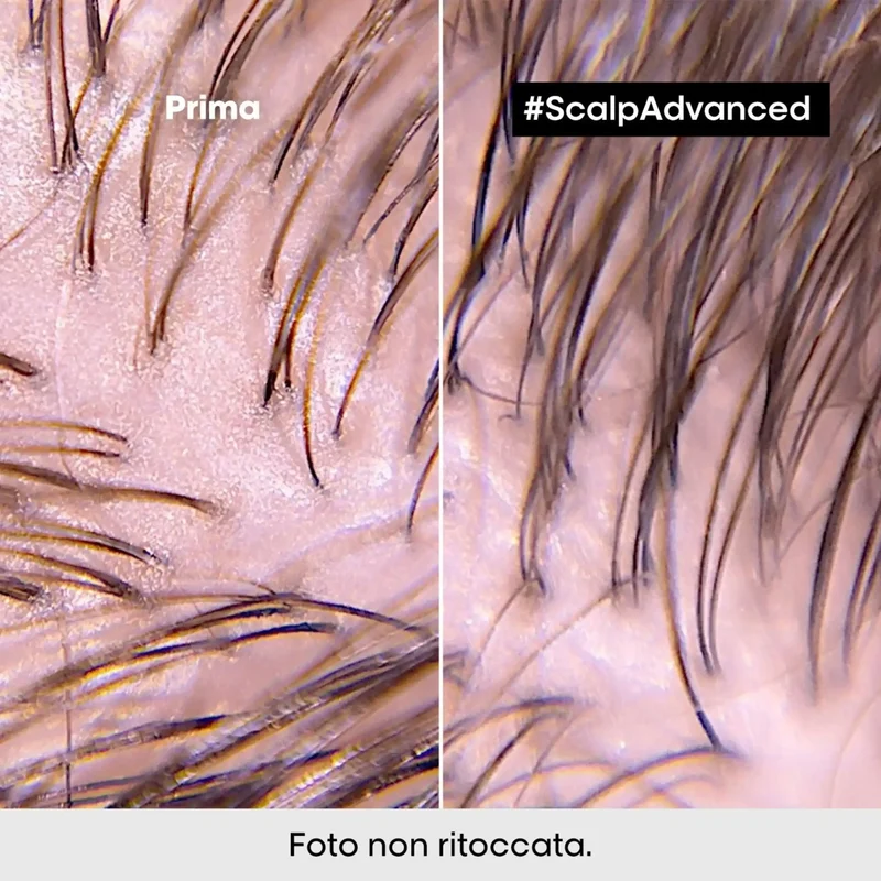 L'Oreal Scalp Advanced Shampoo Anti-Oiliness 500 ml