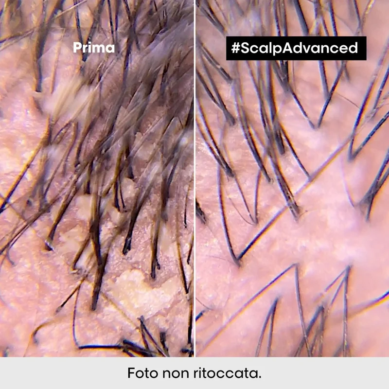 L'Oreal Scalp Advanced Shampoo Anti-Dandruff 500 ml