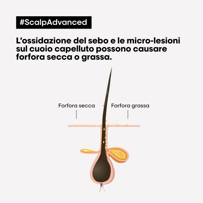 L'Oreal Scalp Advanced Shampoo Anti-Dandruff 500 ml