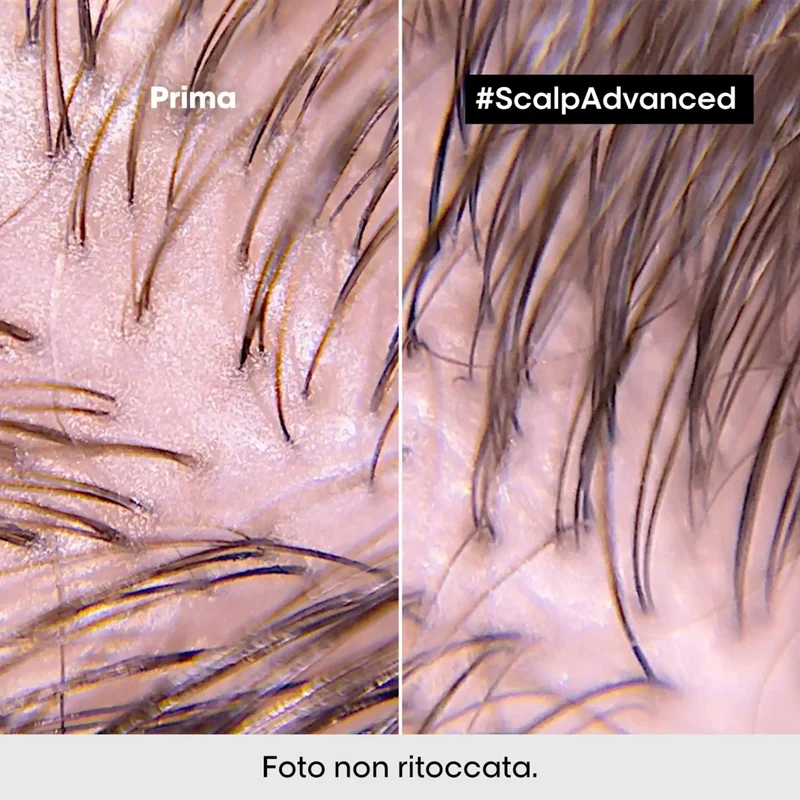 L'Oreal Scalp Advanced Shampoo Anti-Oiliness 500 ml